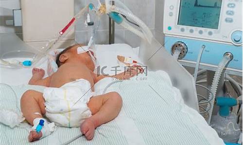 呼吸仿真器在新生儿护理中的应用探讨