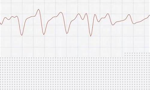 如何使用心率模拟器提升运动表现