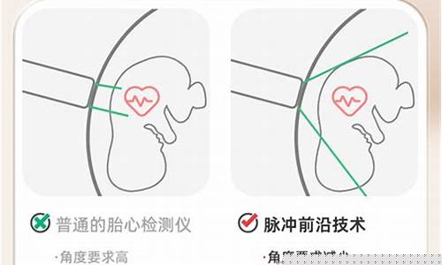 胎心检测仪的工作原理与使用方法解析