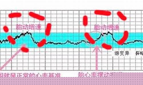 从数据分析看胎心模拟系统的精准性