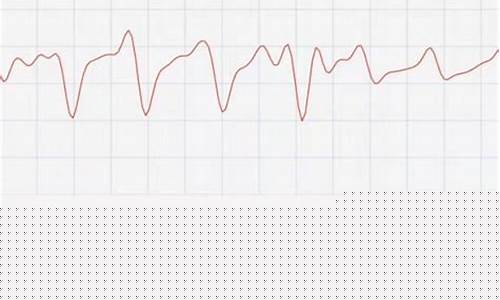心率检测仪如何帮助监测老年人健康
